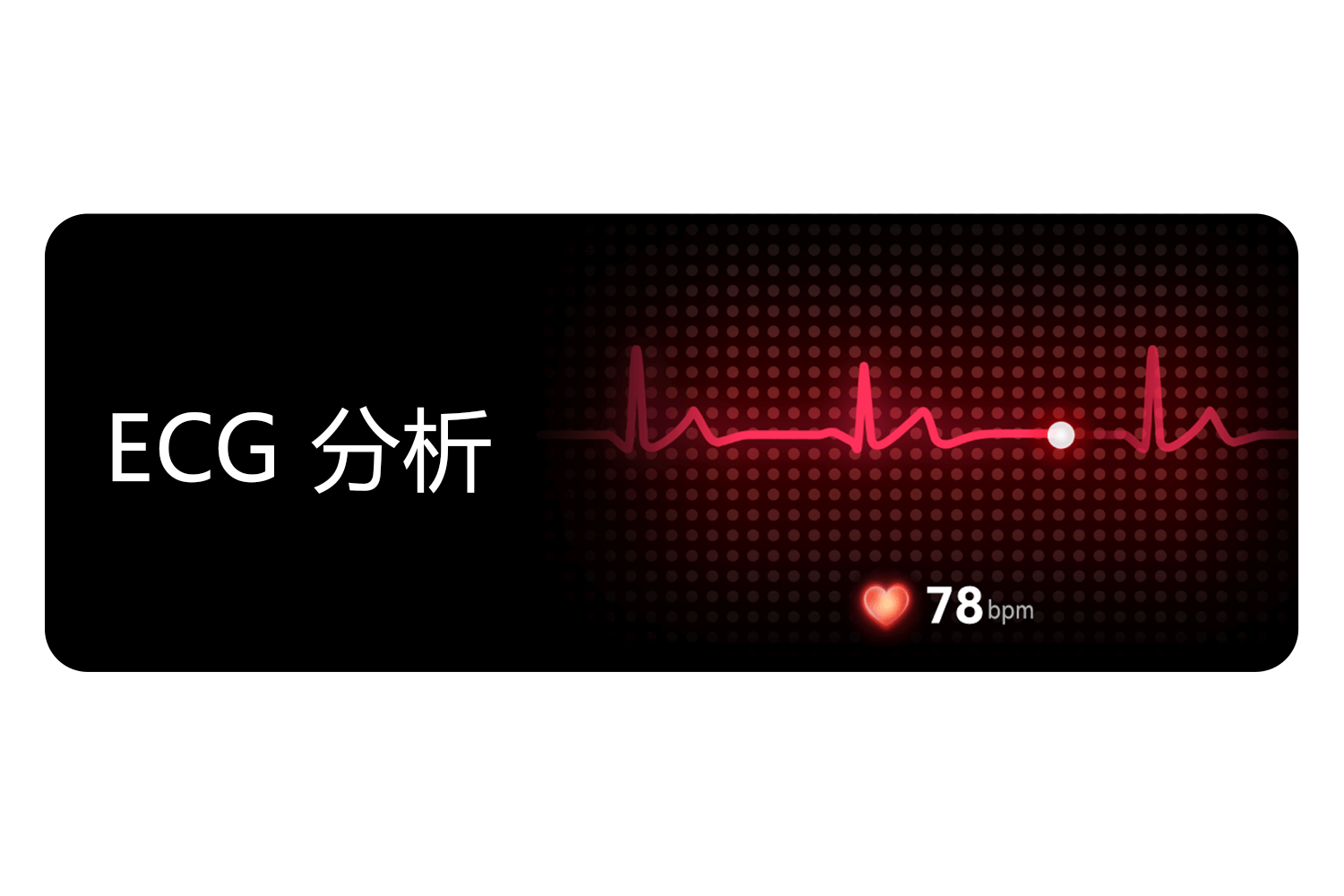 ECG 分析